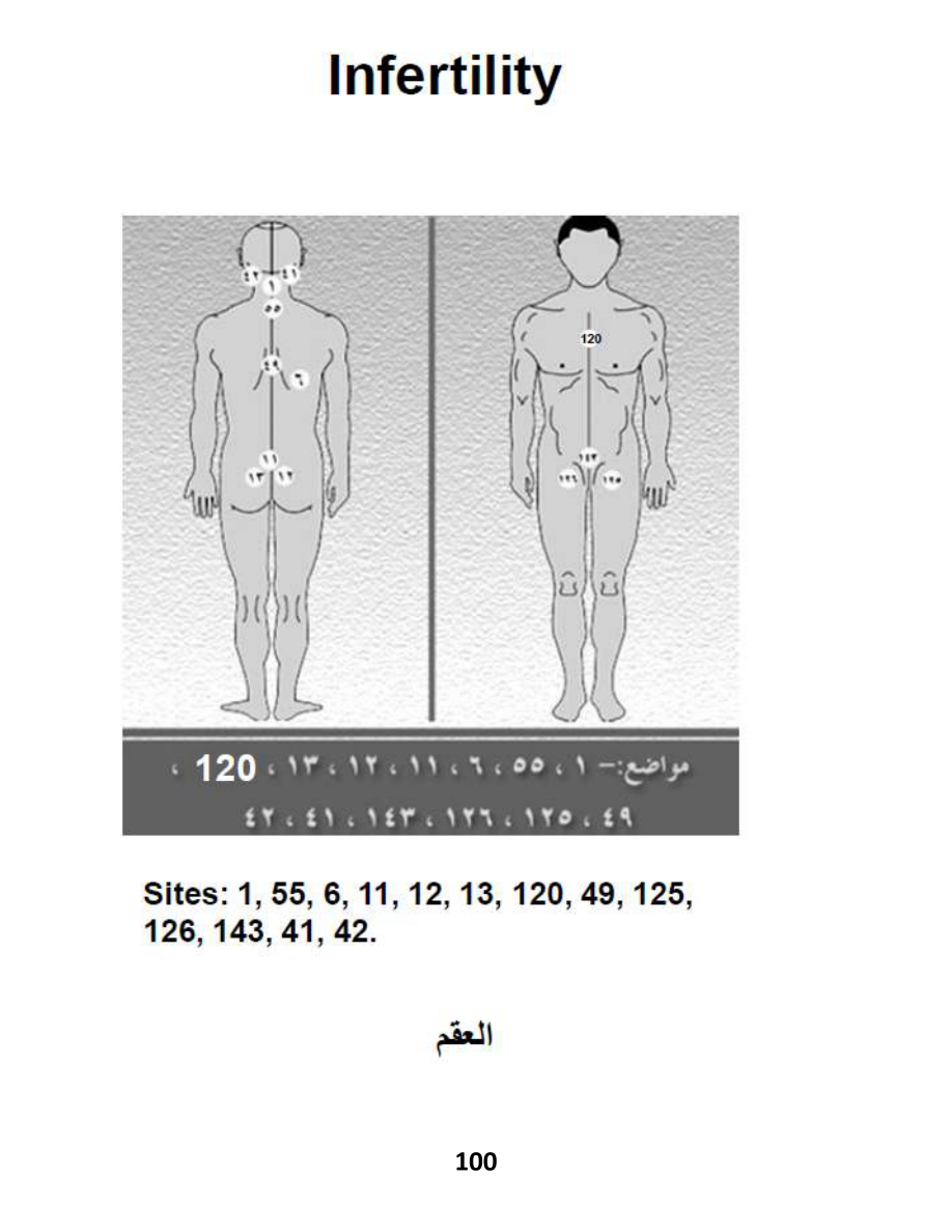 Hijama Atlas — page 100 — Female Infertility (Supportive)
