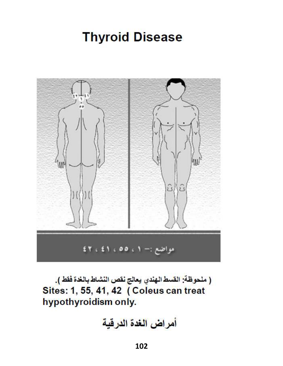 Hijama Atlas — page 102 — Hypothyroidism