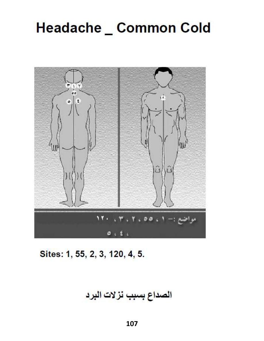 Hijama Atlas — page 107 — Common Cold