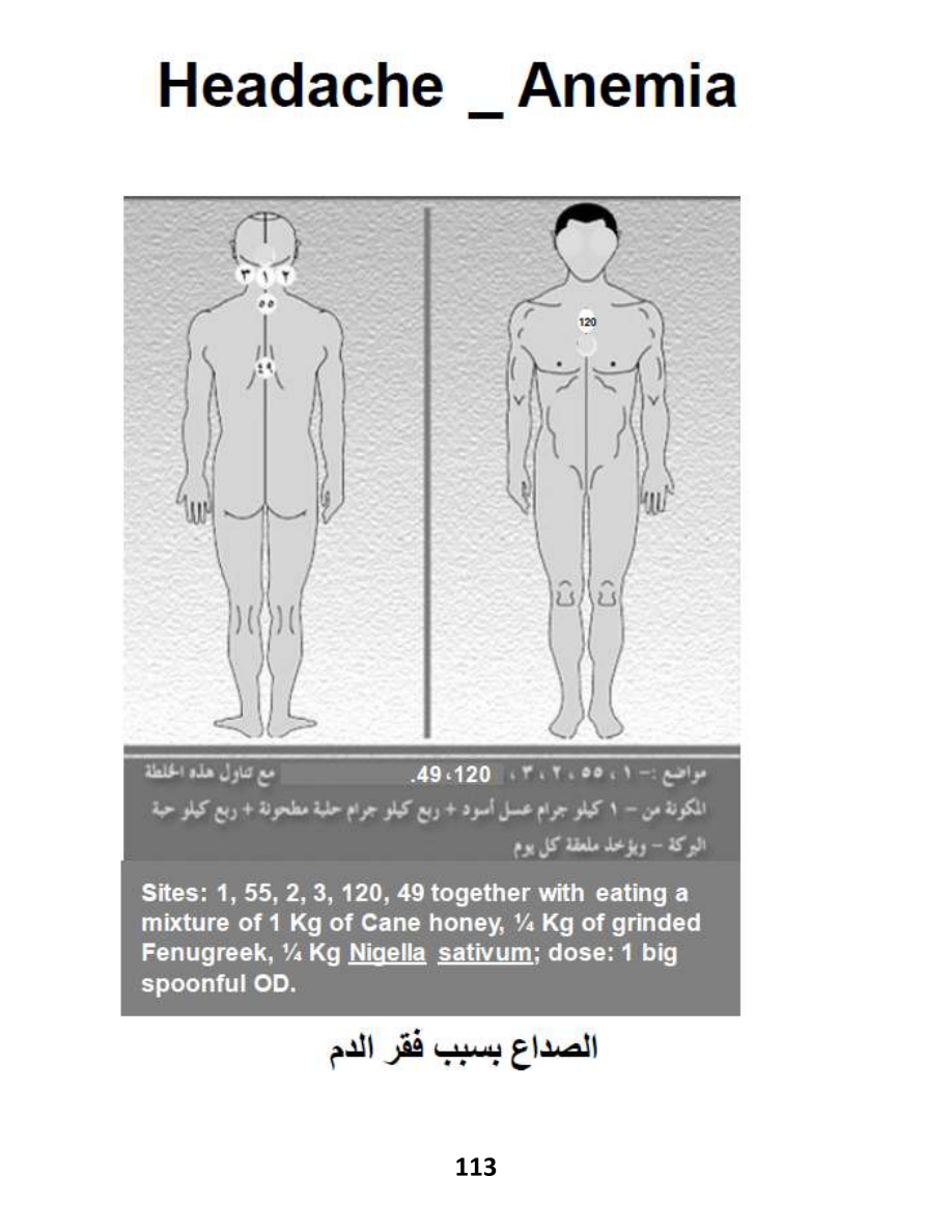Hijama Atlas — page 113 — Iron Deficiency Anemia