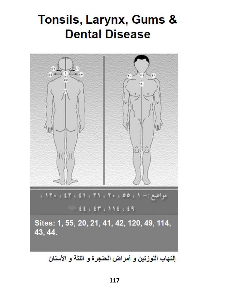 Hijama Atlas — page 117 — Tonsillitis