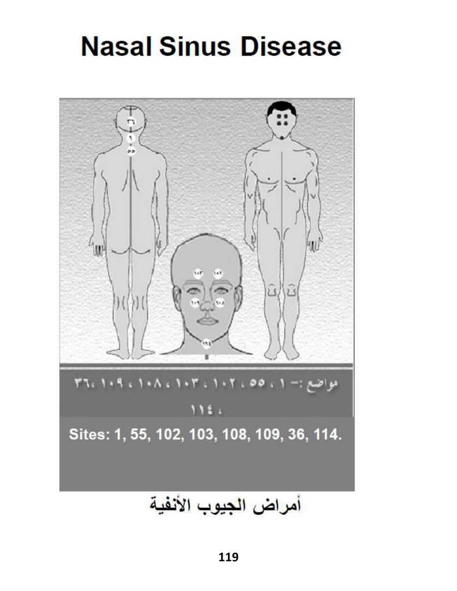 Hijama Atlas — page 119 — Allergic Rhinitis / Seasonal Allergies