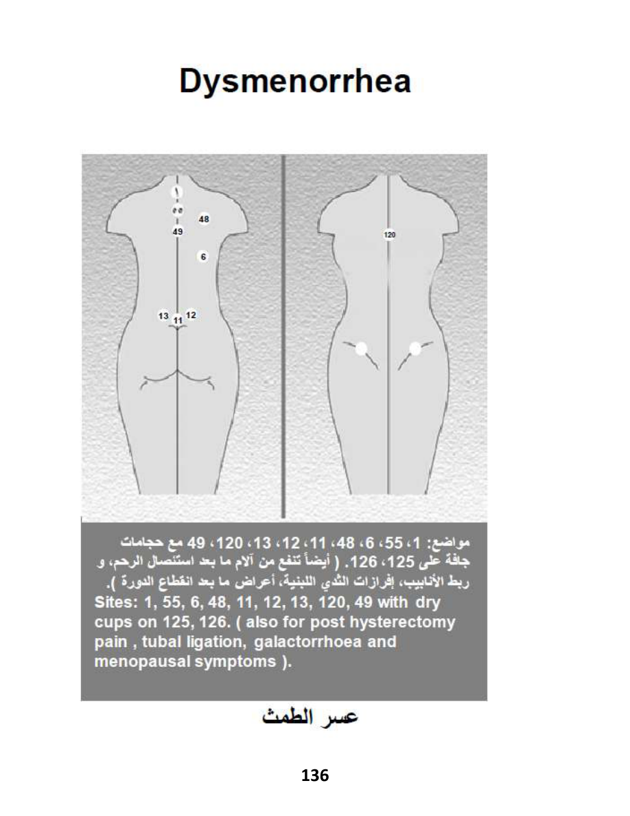 Hijama Atlas — page 136 — Dysmenorrhea (Period Pain)