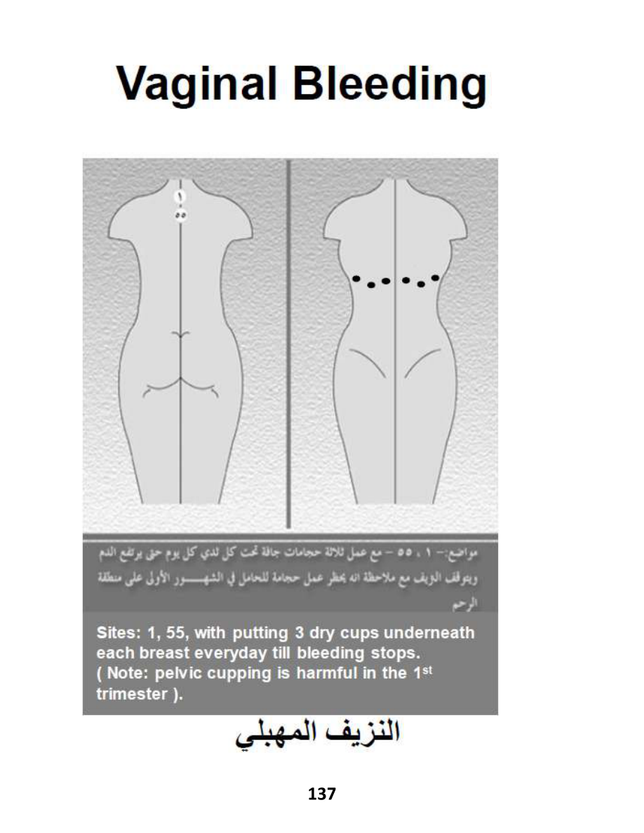 Hijama Atlas — page 137 — Pregnancy Wellness Support