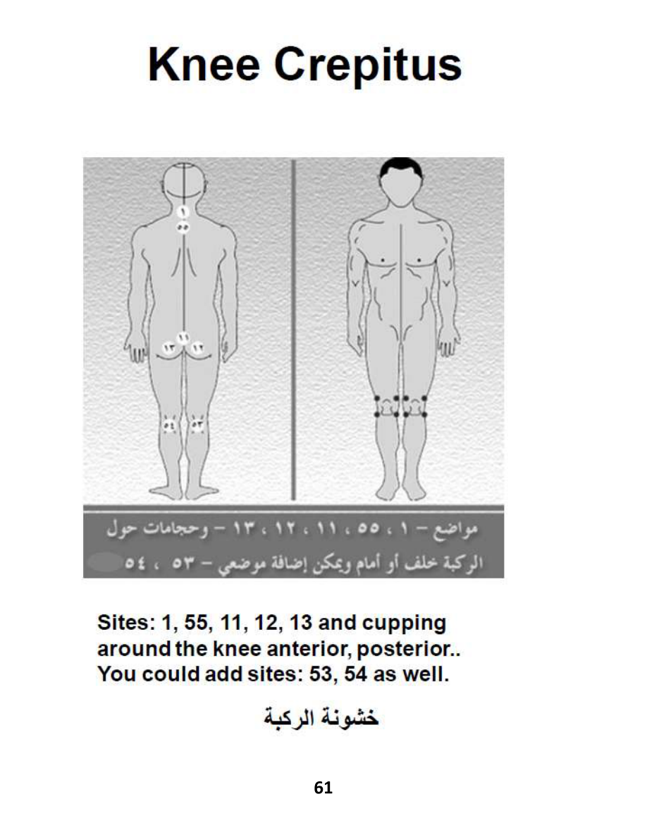 Hijama Atlas — page 61 — Knee Pain & Osteoarthritis