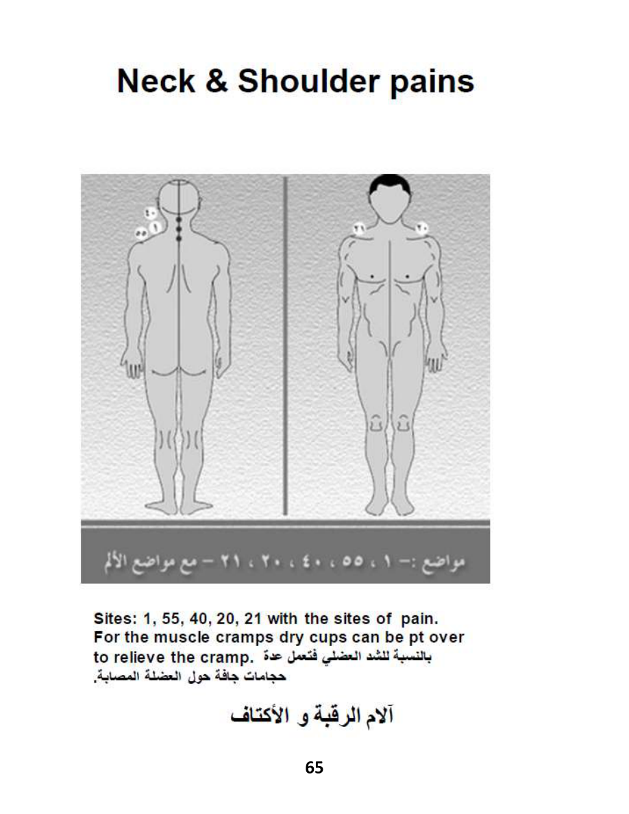 Hijama Atlas — page 65 — Frozen Shoulder (Adhesive Capsulitis)
