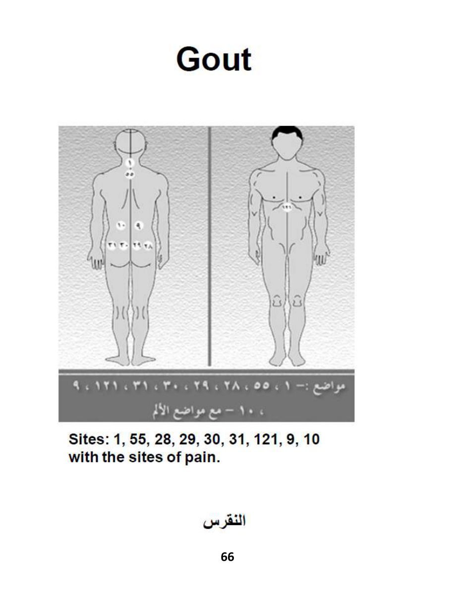 Hijama Atlas — page 66 — Gout