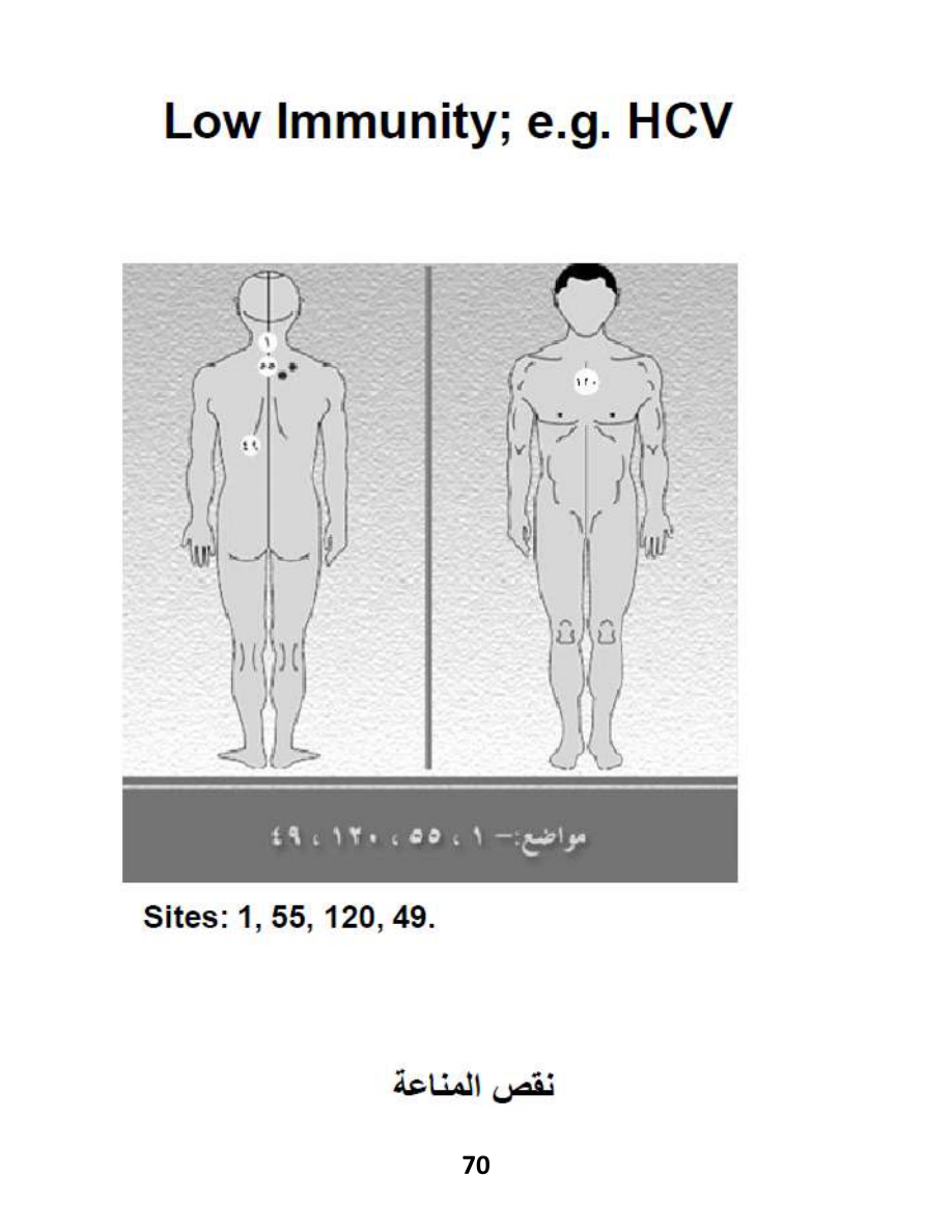 Hijama Atlas — page 70 — Sihr (Spiritual Protection)