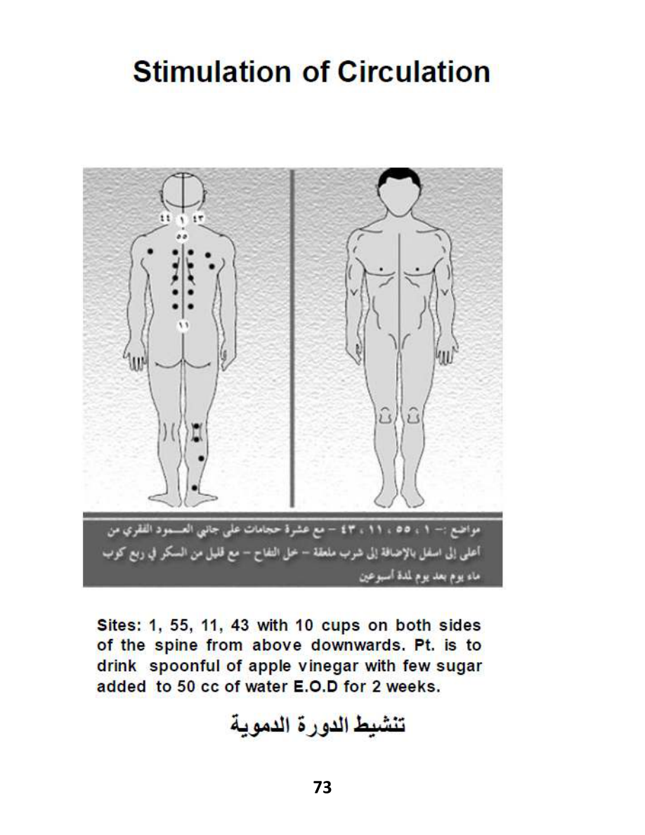 Hijama Atlas — page 73 — High Cholesterol (Dyslipidemia)
