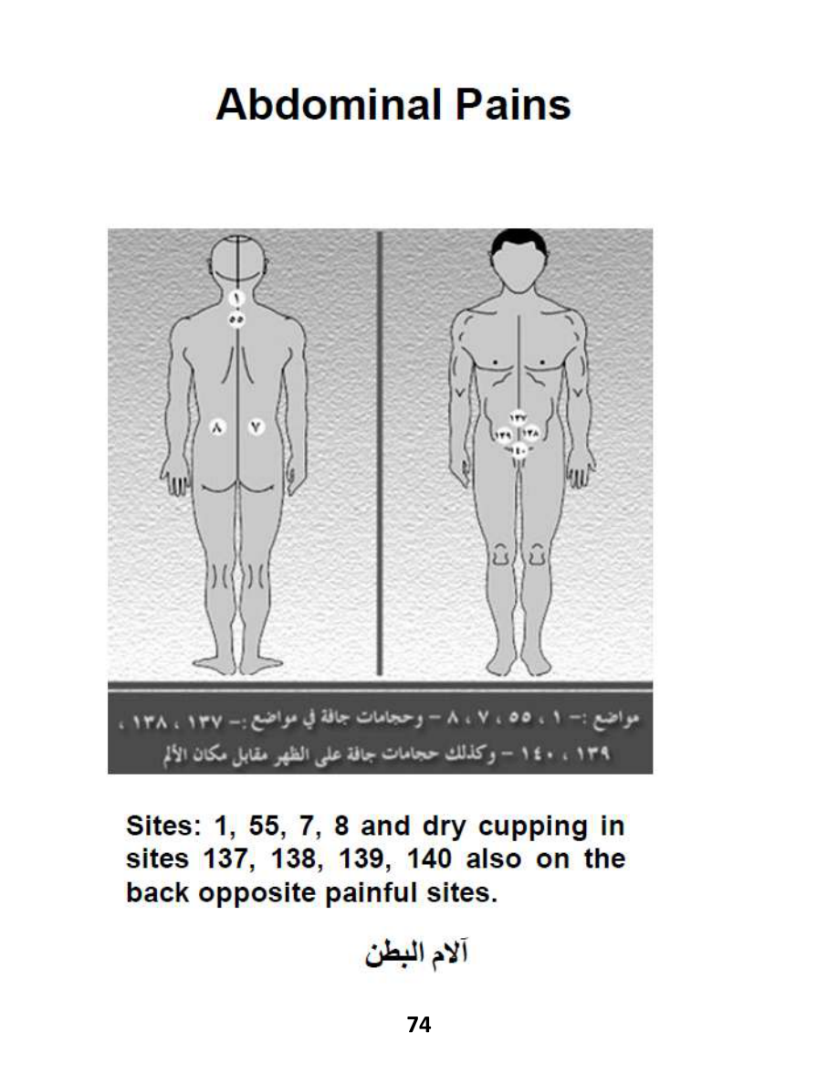 Hijama Atlas — page 74 — Chronic Nausea