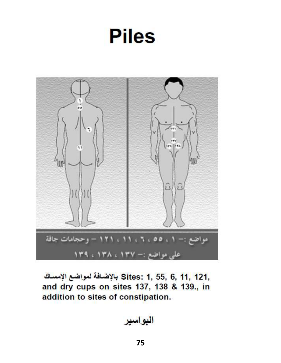 Hijama Atlas — page 75 — Hemorrhoids