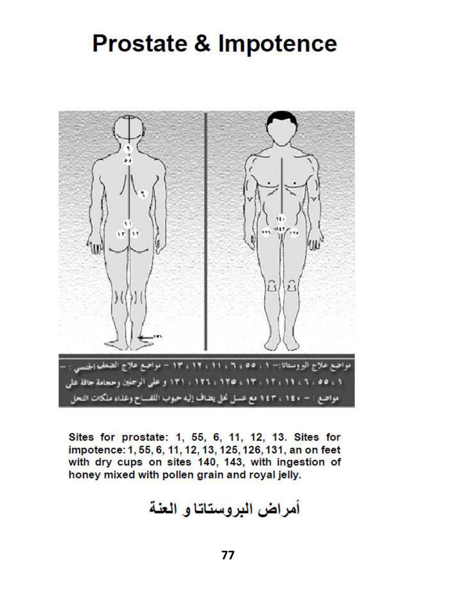Hijama Atlas — page 77 — Erectile Dysfunction