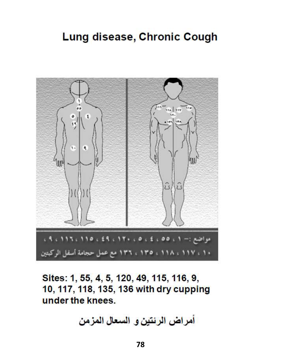 Hijama Atlas — page 78 — COPD (Chronic Obstructive Pulmonary Disease)