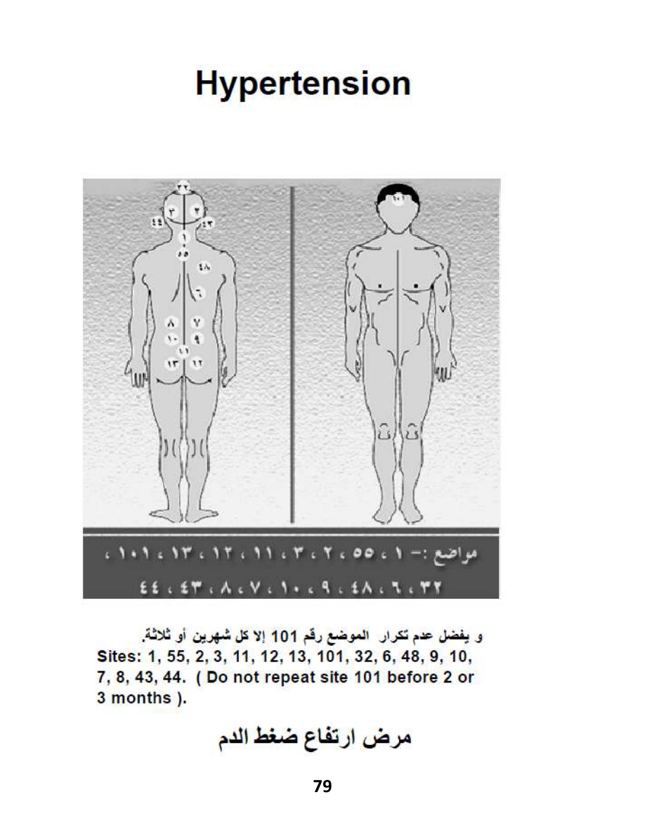 Hijama Atlas — page 79 — Hypertension (High Blood Pressure)