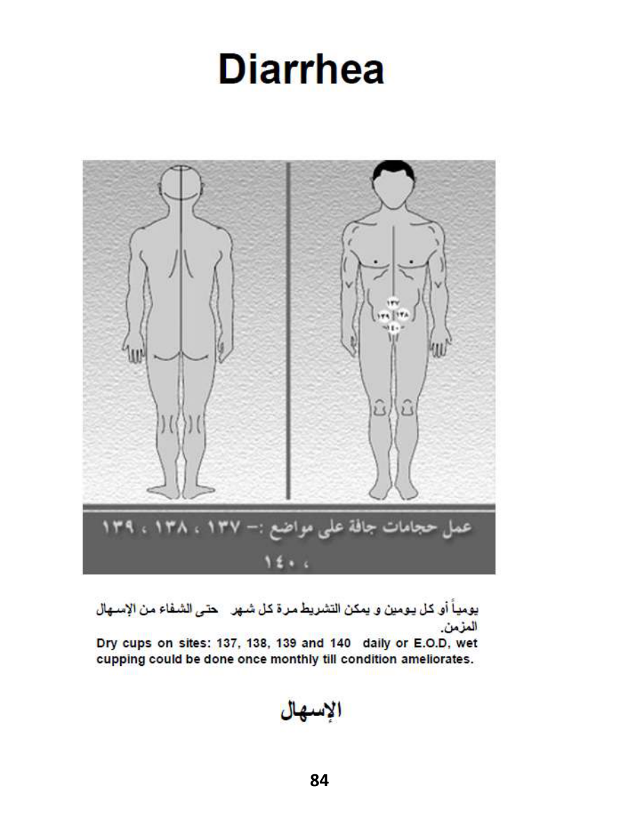 Hijama Atlas — page 84 — Infant Colic