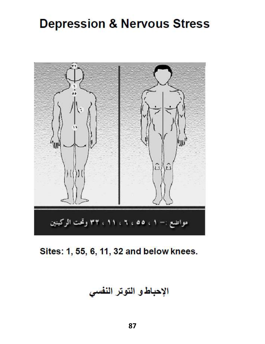Hijama Atlas — page 87 — Anger Management