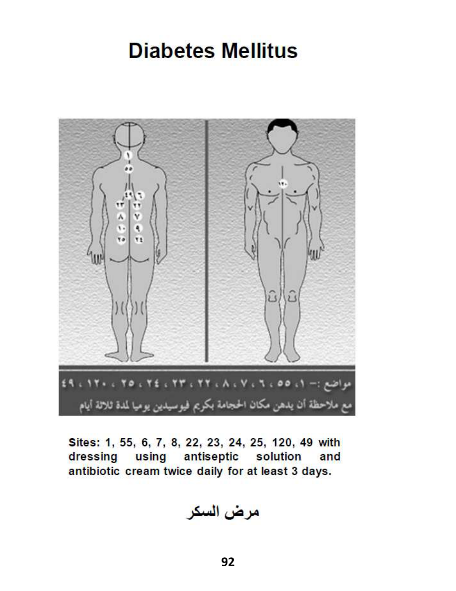 Hijama Atlas — page 92 — Hypoglycemia