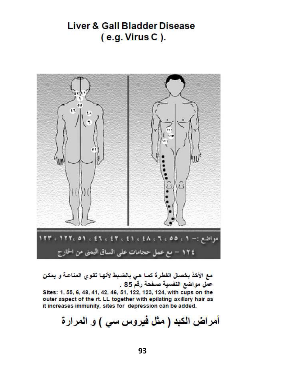Hijama Atlas — page 93 — Non-Alcoholic Fatty Liver Disease