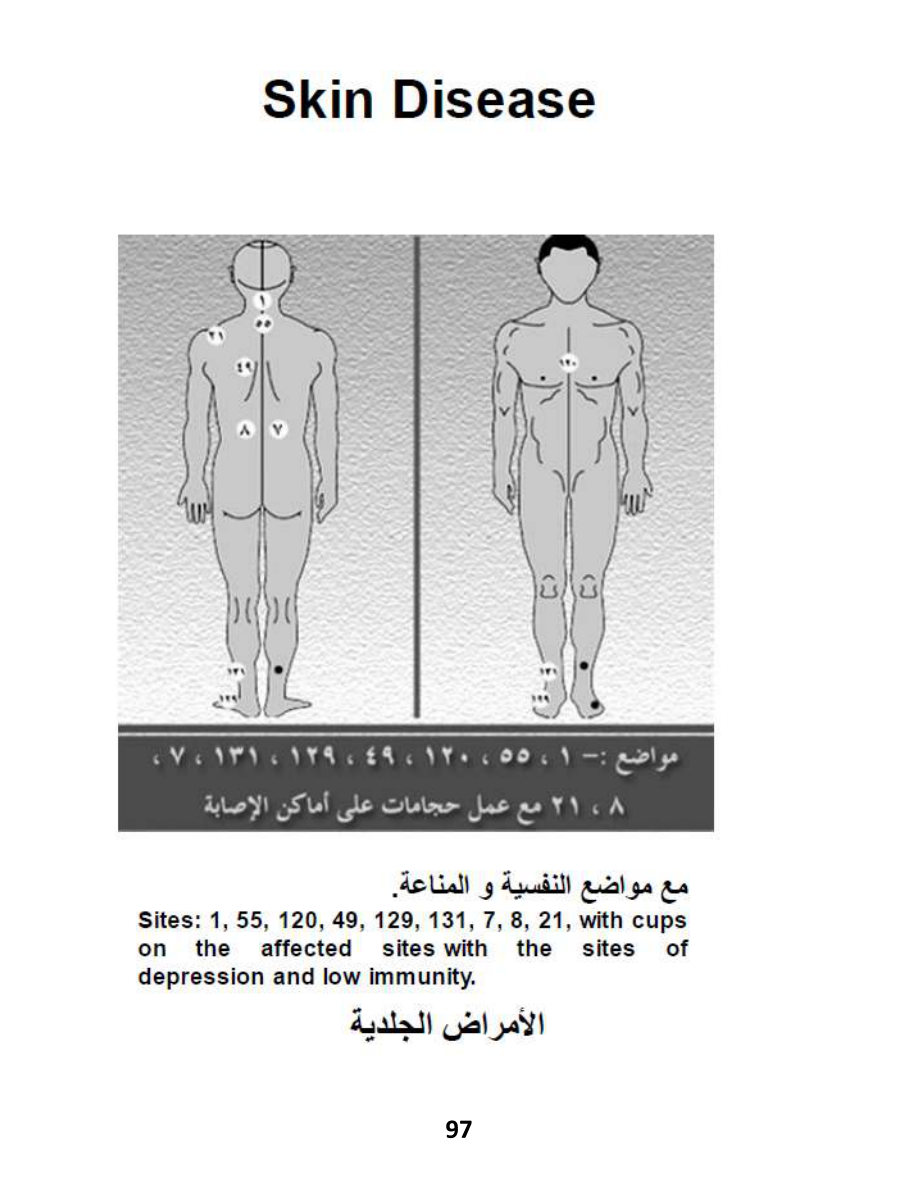 Hijama Atlas — page 97 — Dandruff