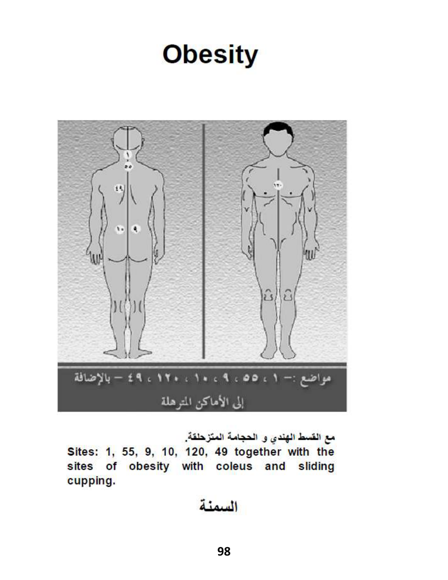 Hijama Atlas — page 98 — Obesity